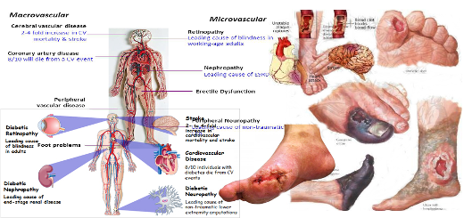 understanding-the-diabetes-complications-effects-life-vibrant